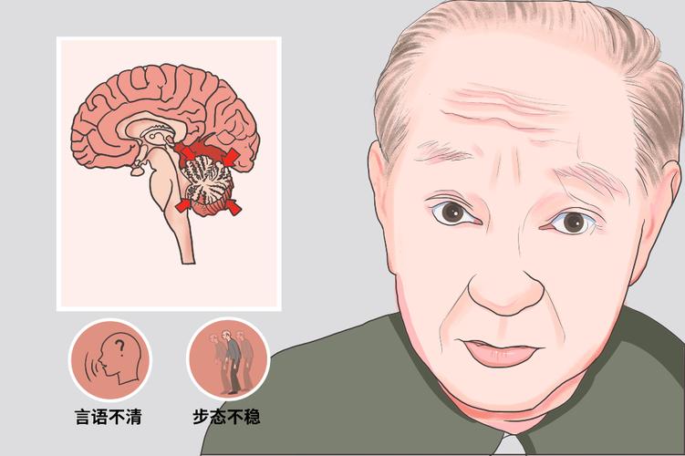 澳门开特马+开奖结果走势和送小脑萎缩儿子高考与小脑萎缩能上学吗